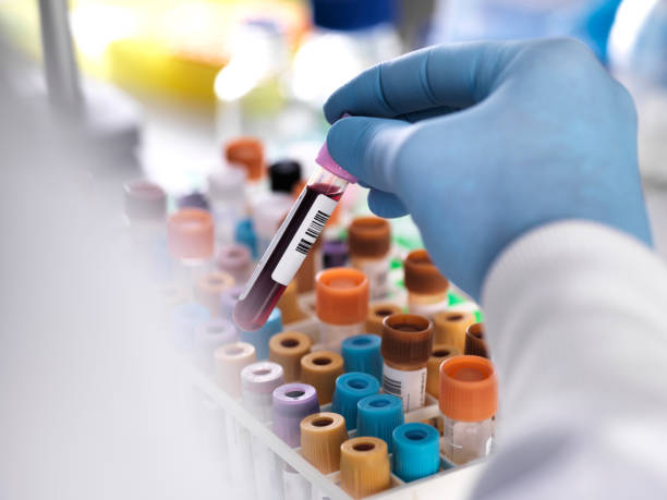Diagnostics